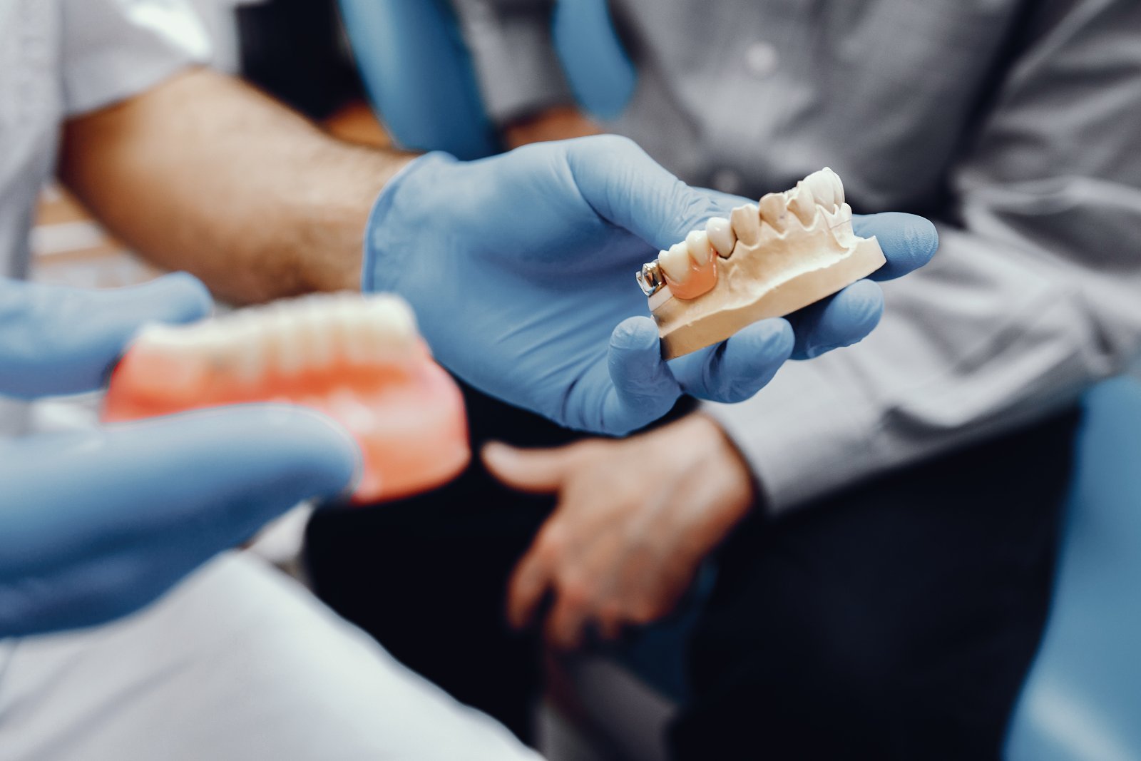 Dental Implants: Benefits