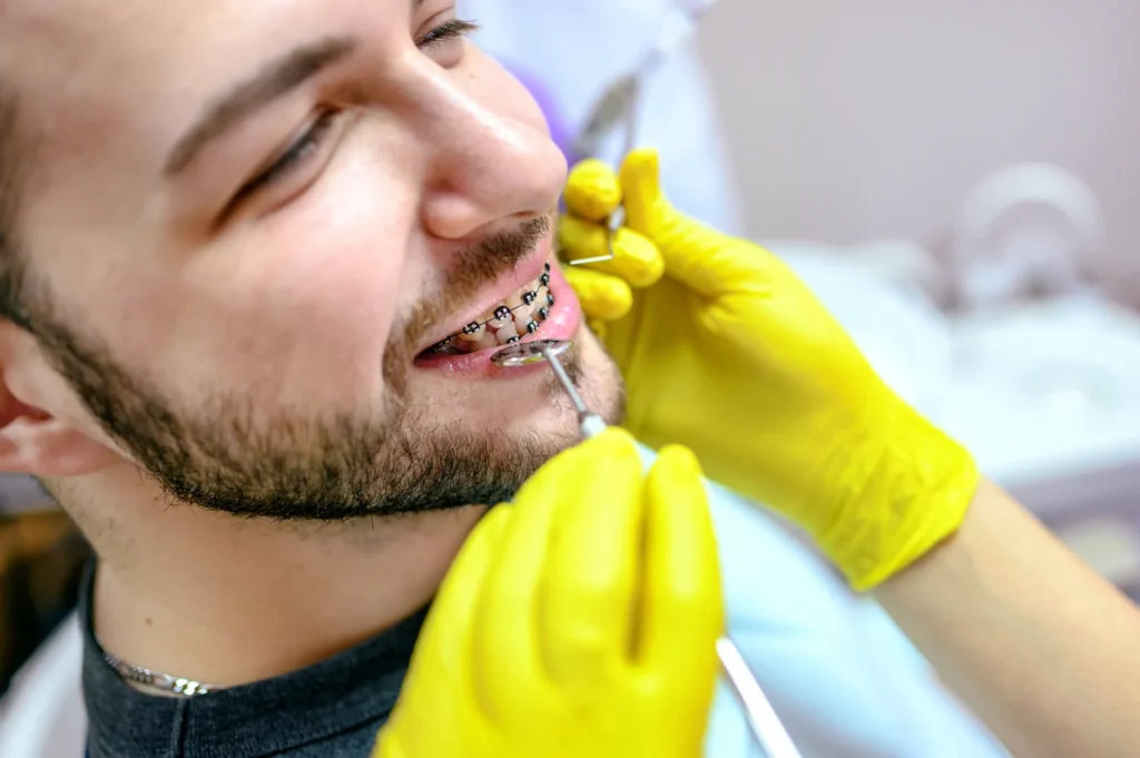 metal braces treatment
