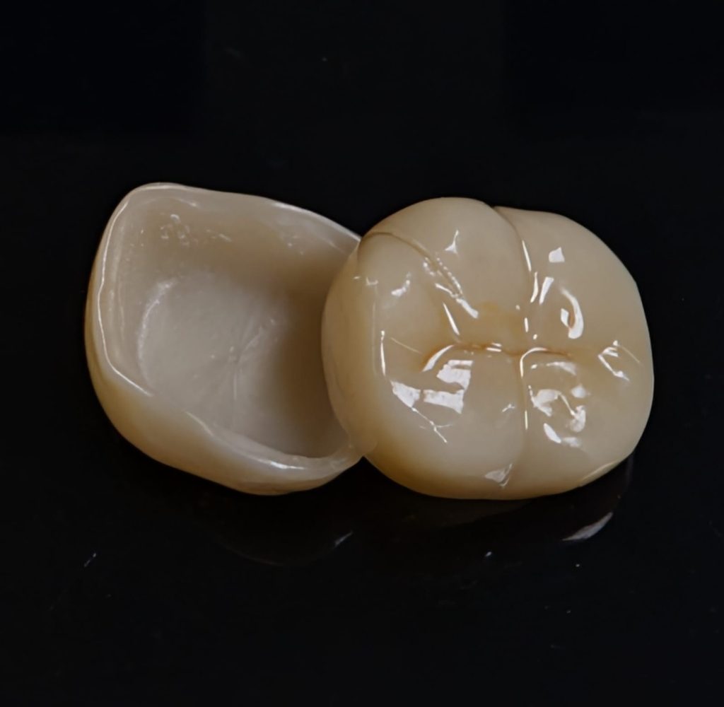 What Is a Dental Crown? image of a zirconia dental crown
